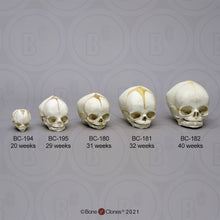 Load image into Gallery viewer, Bone Clones Fetal Human Skulls Set Of 5 Homo sapiens 20 To 40 Weeks Medical replicas casts reproductions