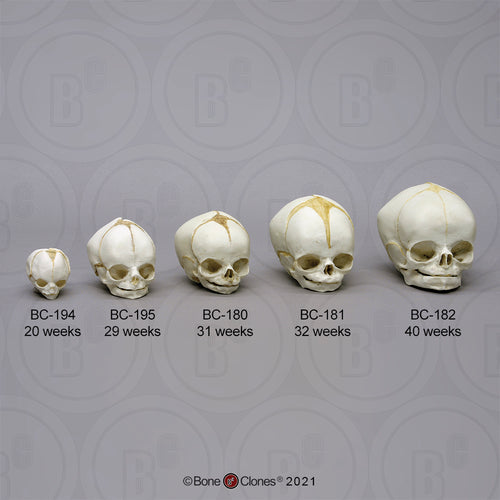 Bone Clones Fetal Human Skulls Set Of 5 Homo sapiens 20 To 40 Weeks Medical replicas casts reproductions