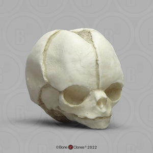 Bone Clones Fetal Human Skulls Set Of 5 Homo sapiens 20 To 40 Weeks Medical replicas casts reproductions