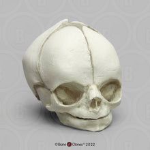 画像をギャラリービューアに読み込む, Bone Clones Fetal Human Skulls Set Of 5 Homo sapiens 20 To 40 Weeks Medical replicas casts reproductions
