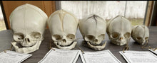 Load image into Gallery viewer, Bone Clones Fetal Human Skulls Set Of 5 Homo sapiens 20 To 40 Weeks Medical replicas casts reproductions