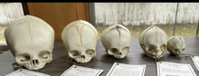 Cargar imagen en el visor de la galería, Bone Clones Fetal Human Skulls Set Of 5 Homo sapiens 20 To 40 Weeks Medical replicas casts reproductions