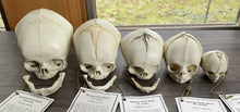 Charger l&#39;image dans la galerie, Bone Clones Fetal Human Skulls Set Of 5 Homo sapiens 20 To 40 Weeks Medical replicas casts reproductions