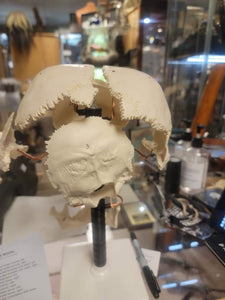 Beauchene Human Exploded skull cast replica